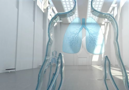 Mucosolvan “Giant Ballons”